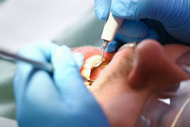 Best Emergency Treatment for Dental Infections or Abscesses in Thief River Falls, MN