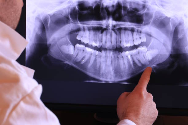 Best Emergency Treatment for Dental Infections or Abscesses in Thief River Falls, MN