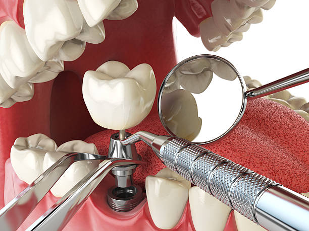 Best Weekend Emergency Dentist in Thief River Falls, MN